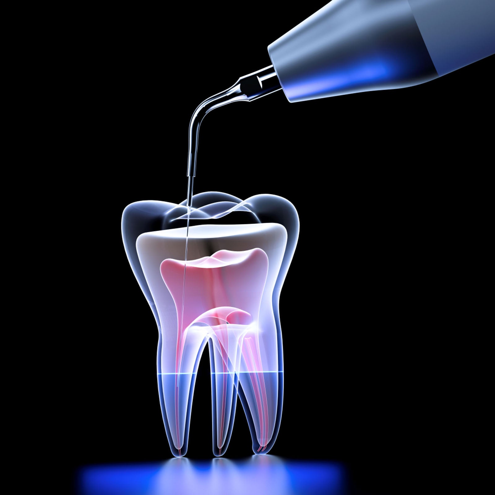 Woodpecker U600 LED Ultrasonic Piezo Scaler with Auto Water Bottle 7 Tips - azdentall.com