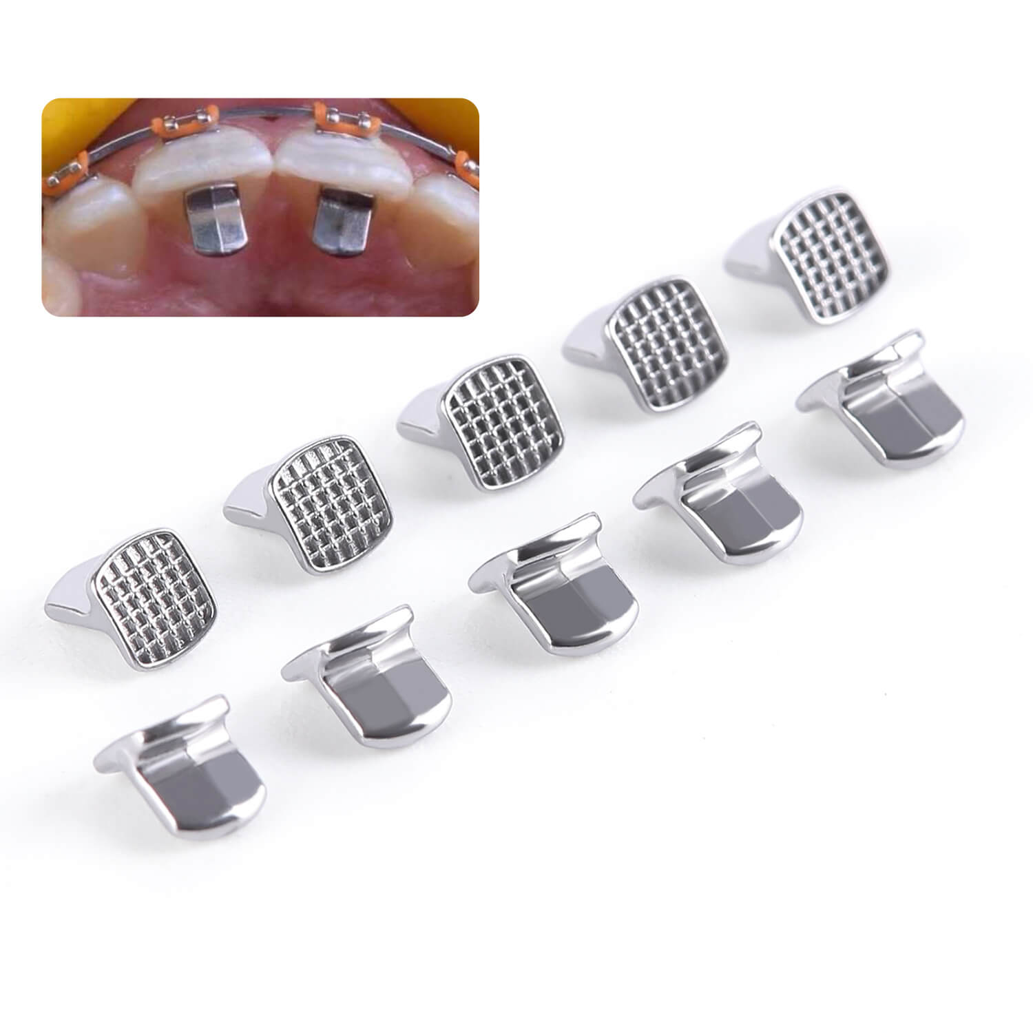AZDENT Orthodontic Bondable Bite Turbos Monoblock Hinge 50pcs/Box - azdentall.com