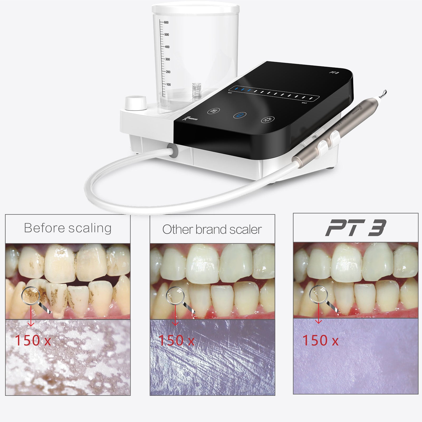 WOODPECKE PT3 Dental Periodontal Treatment Device Auto Water Supply System - azdentall.com
