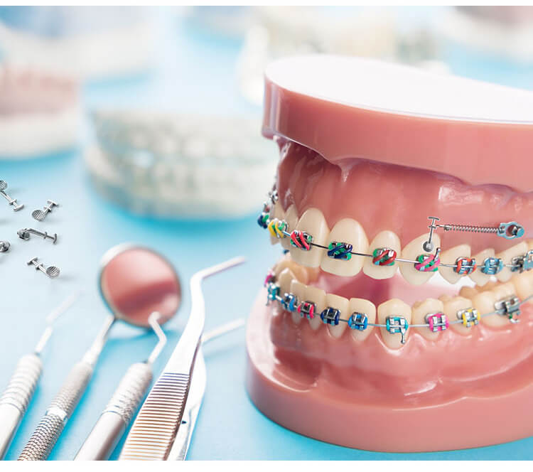 AZDENT Orthodontic Multi Hook Lingual Buttons Bondable Monoblock Round Base 10pcs/Bag - azdentall.com