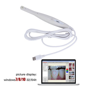 Dental USB Intraoral Camera 8 LED Light High Resolution CMOS 1/4 Sensor - azdentall.com