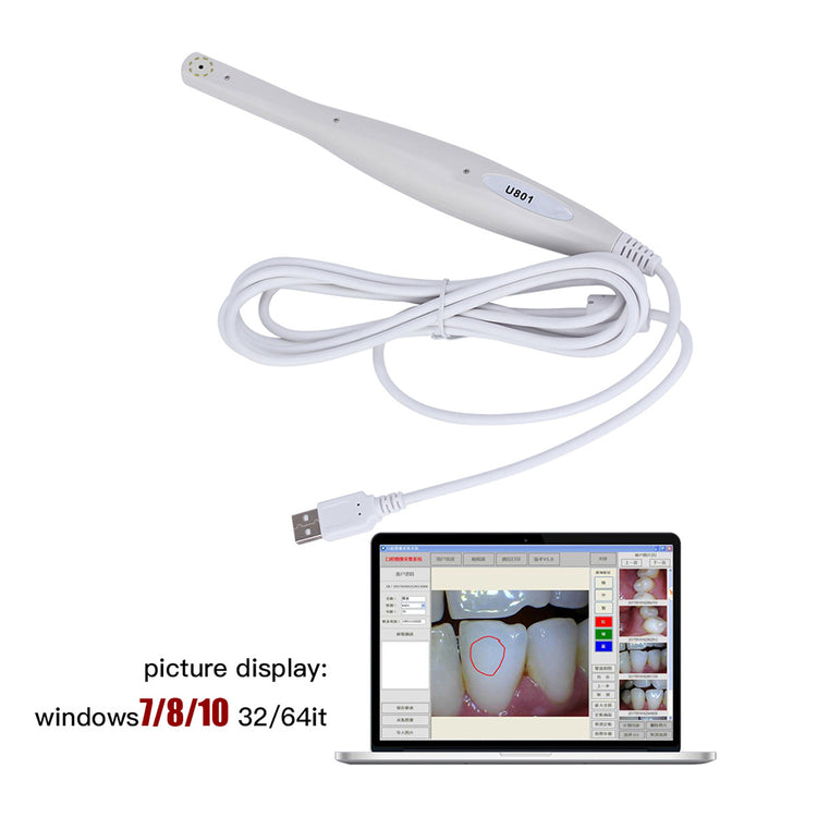 Dental USB Intraoral Camera 8 LED Light High Resolution CMOS 1/4 Sensor - azdentall.com