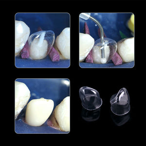 Dental Anterior Transparent Crowns for Aldult № 1.910 64Pcs/Box - azdentall.com