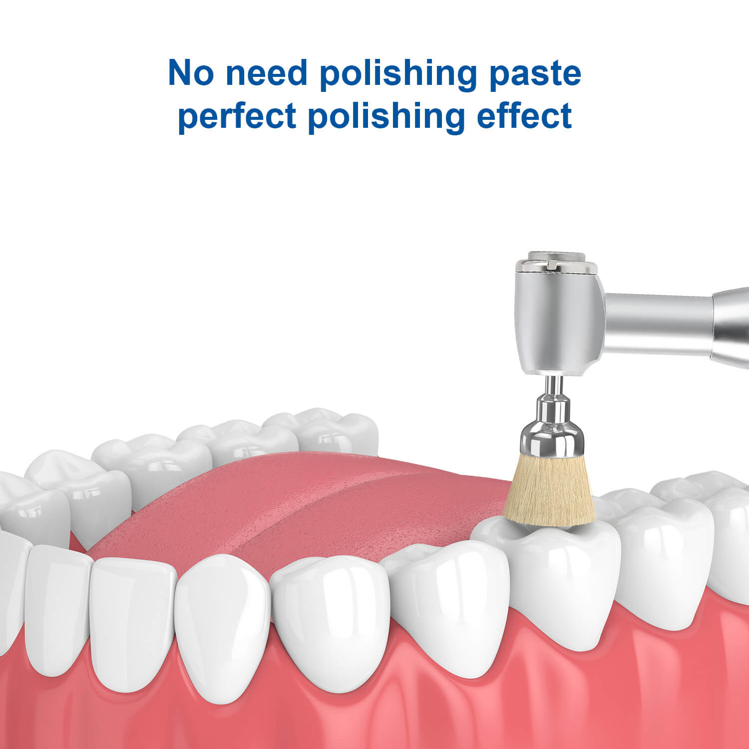 Dental Bristle Prophy Polishing Brush Bowl Shape 10pcs/Pack - azdentall.com