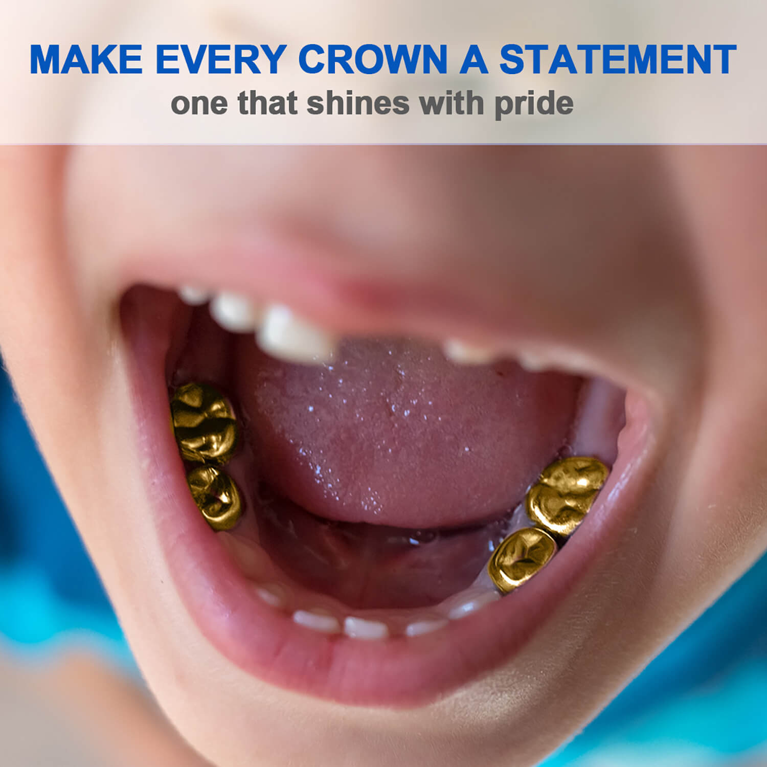 48 Sizes Dental Gold Primary Molar Kids Crown Stainless Steel Preformed Temporary Crowns 5pcs/Box - azdentall.com