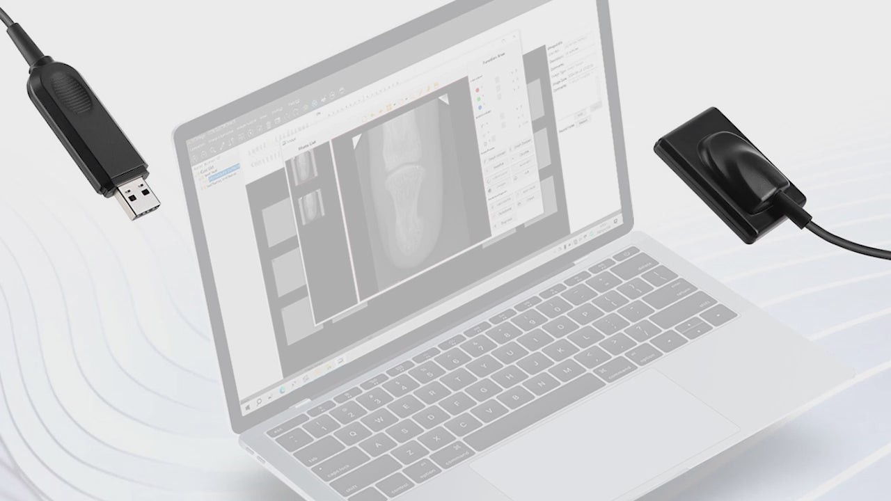 Load video: Dental Sensor X-Ray Digital Sensor Intraoral Digital System HD Image Size1/Size2 - azdentall.com