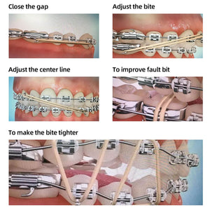 Orthodontic Intra Oral Elastics Rubber Bands Latex Braces Force 3.5 OZ 5000pcs/Box - azdentall.com