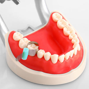 Dental Forming Sheet Orthodontic Sectional Contoured Metal Matrice Polyester 20pcs/box - azdentall.com
