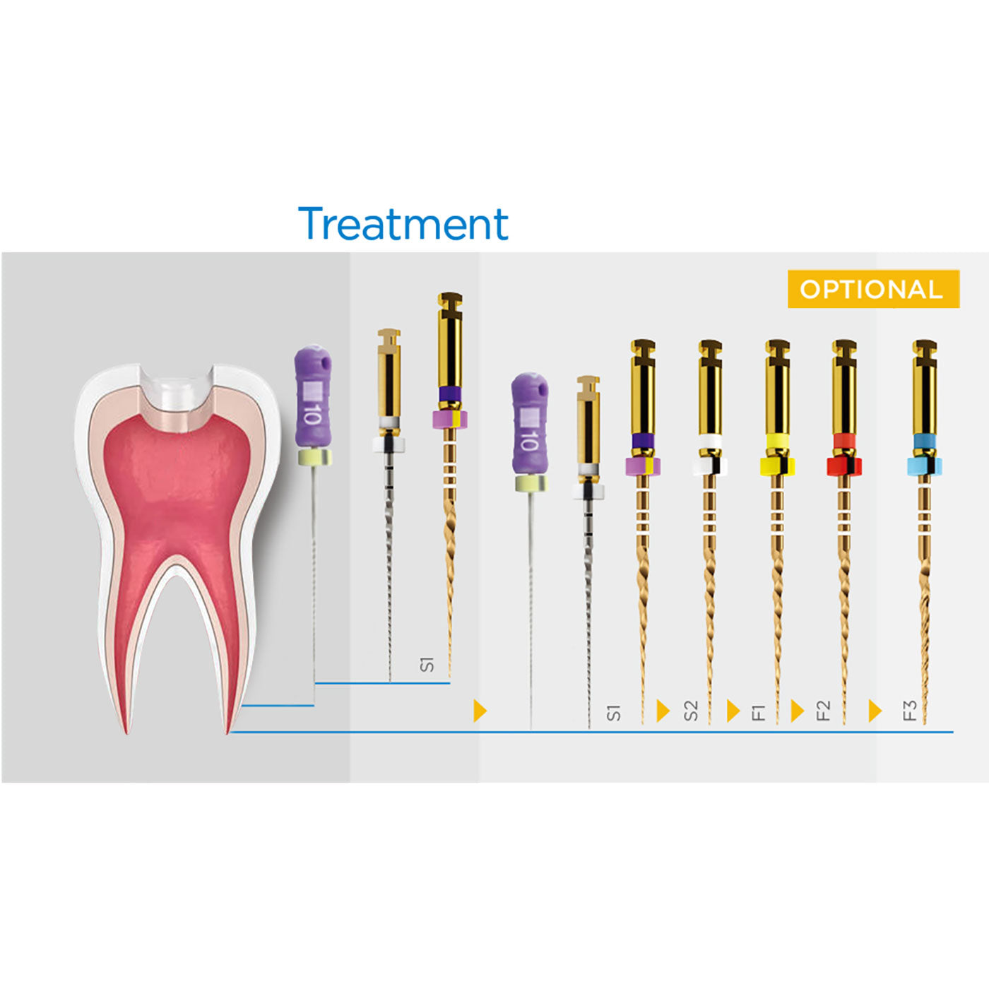 AZDENT Dental Rotary NiTi Files 25mm Assorted SX-F3 Gold Taper 6pcs/Pk
