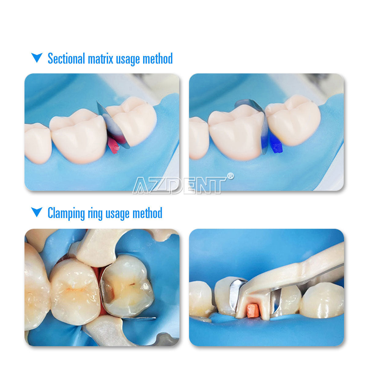 Universal Dental Sectional Contoured Metal Matrix Bands Refill – 4 Types