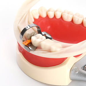 Dental Prime Teeth Interproximal Plastic Wedge with Protection Dental Steel Matrix Medium Orange 50/Box