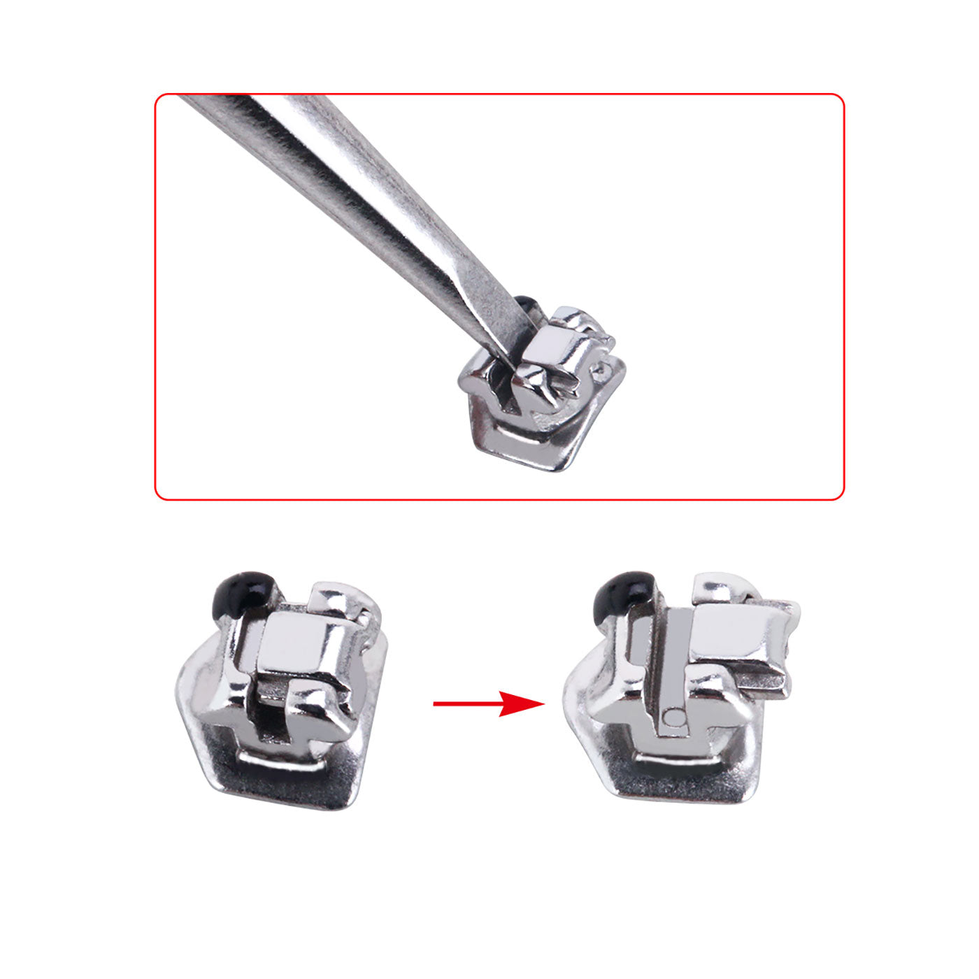 AZDENT Dental Orthodontic Metal Self-Ligating Brackets Braces MBT .022 Hooks on 345 with Buccal Tube 28pcs/Kit - azdentall.com