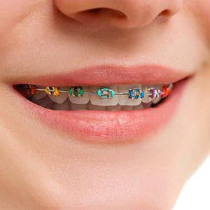 AZDENT Orthodontic Ligature Ties Multi-Color & Clear Color 1014pcs/pack - azdentall.com