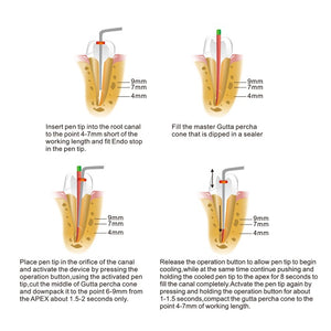 Dental Wirelesss Gutta Percha Obturation Endo Heated Pen-azdentall.com