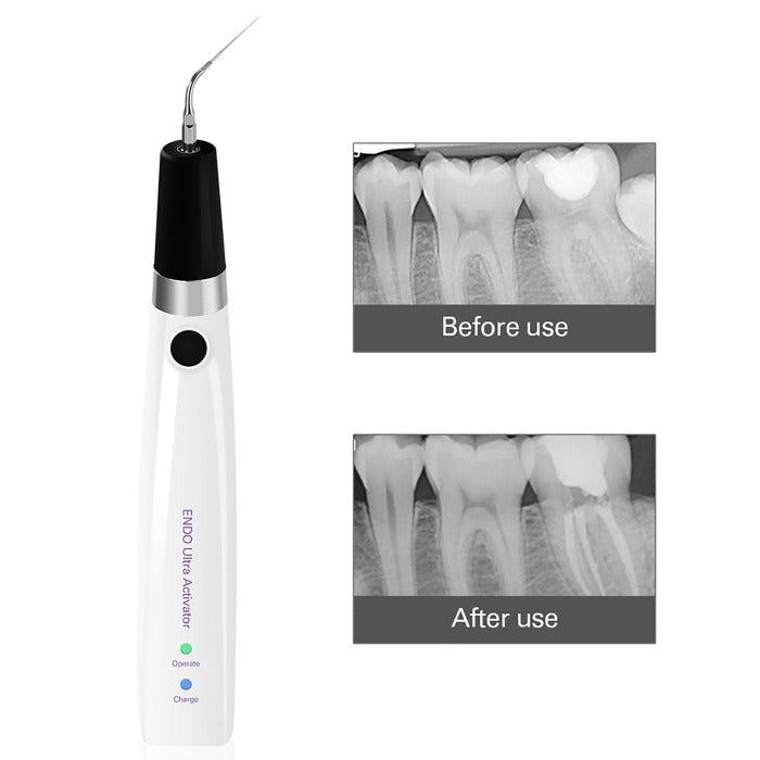 Dental Ultrasonic Activator Irrigator with 6 Tips Cordless Ultrasonic