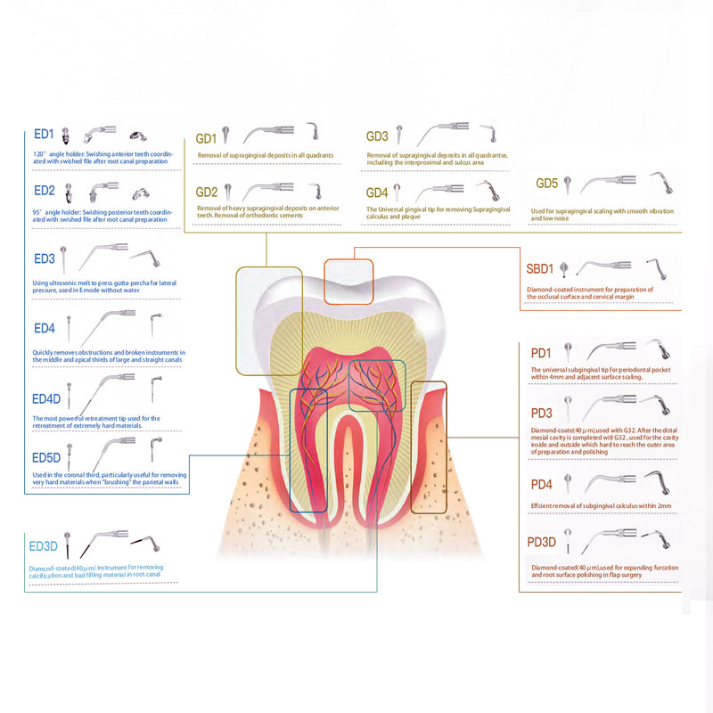 AZDENT Ultrasonic Scaler Endodontic Tips ED4D