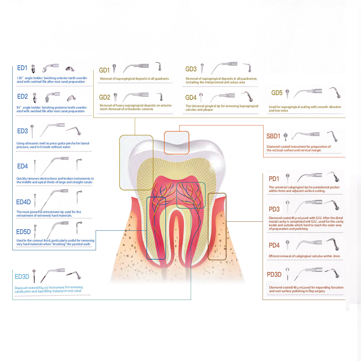 AZDENT Ultrasonic Scaler Periodontic Tips PD4